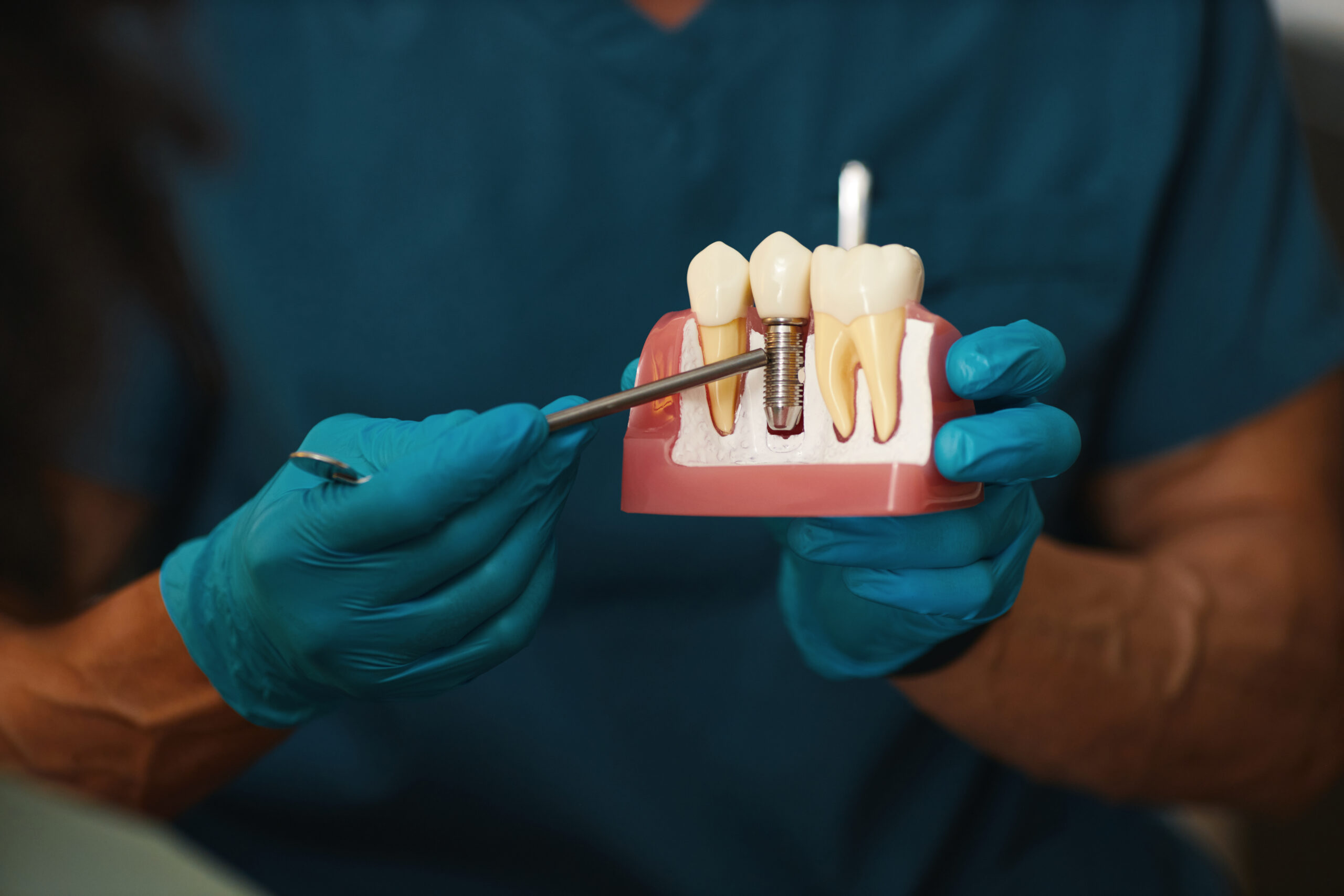 Dentist wearing blue scrubs and gloves explaining dental implant process using a plastic model of teeth. Metal implant and natural teeth are displayed in the model