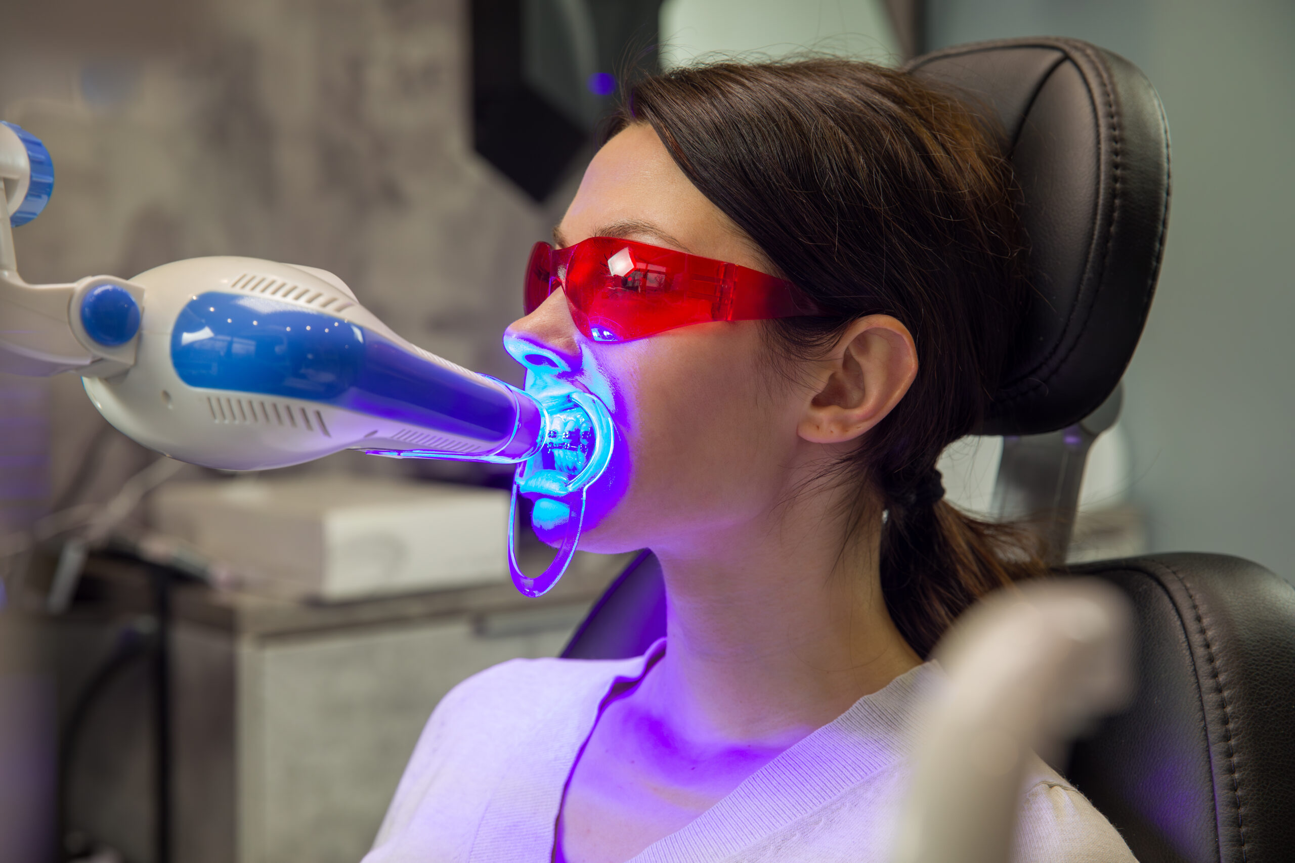 Dental procedure of laser teeth whitening, woman wearing red safety glasses and special mouthpiece